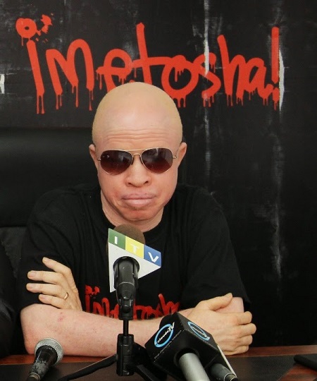 Imetosha Campaign Against Albino Killings in Tanzania - Victims Tourism, giving tourism at Charity tourism